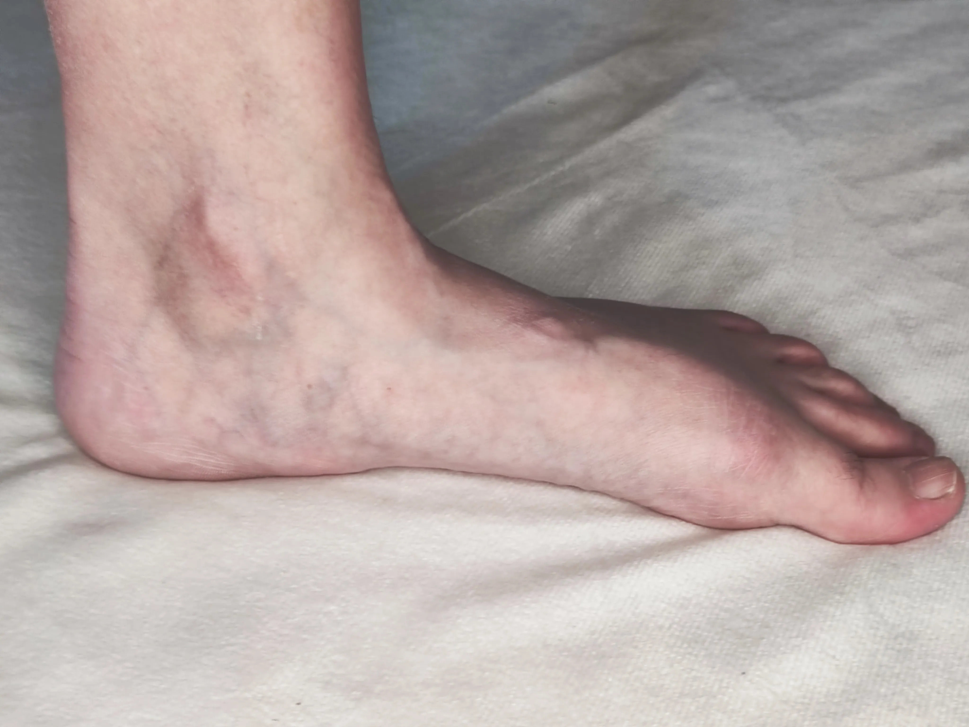 Vue arrière des talons